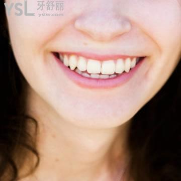 深圳貝臣口腔3M250光固化樹(shù)脂補(bǔ)牙收費(fèi)標(biāo)準(zhǔn)