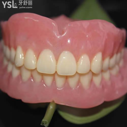 深圳貝臣口腔?吸附性全口義齒價(jià)格表