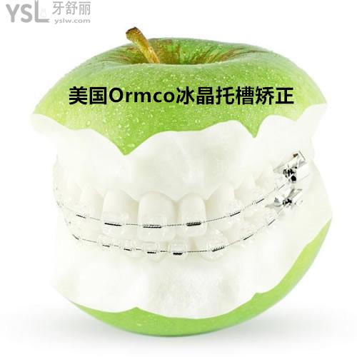 南寧柏樂口腔美國Ormco冰晶托槽矯正價(jià)格貴不貴？