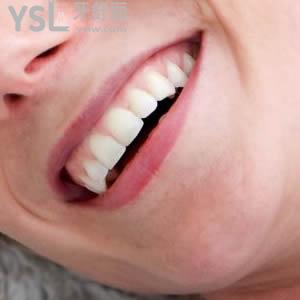 南寧柏樂口腔國產(chǎn)金屬自鎖托槽矯正價(jià)格貴嗎？請(qǐng)把“嗎”去掉。