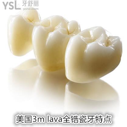 深圳雷蕾口腔診所美國3M LAVA（拉瓦）全瓷牙價格，你知多少？
