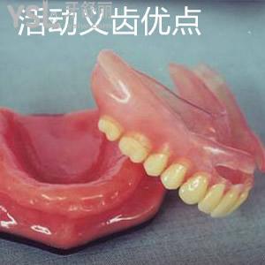 山東日照凱思口腔隱形活動(dòng)義齒價(jià)格