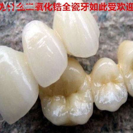 ?包頭植諾口腔做愛爾創(chuàng)全瓷牙怎么樣?公布本院愛爾創(chuàng)全瓷牙價目表及案例