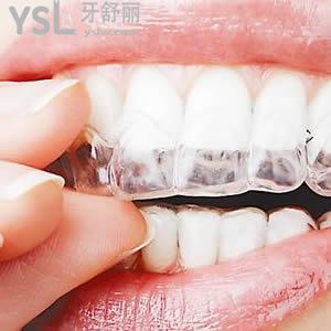鄭州唯美口腔正雅smartee隱形牙齒矯正多少錢(qián)