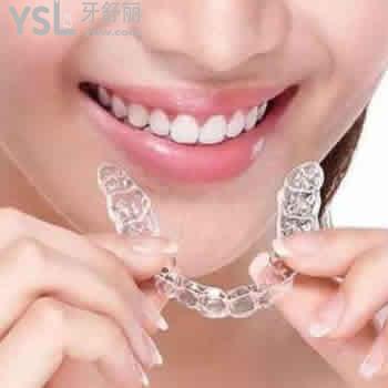 有一份西安畫(huà)美牙科時(shí)代天使正畸價(jià)格表及顧客評(píng)價(jià)參考