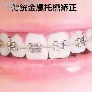 南京雅康口腔醫(yī)院正規(guī)嗎？南京雅康口腔金屬托槽矯正收費(fèi)標(biāo)準(zhǔn)