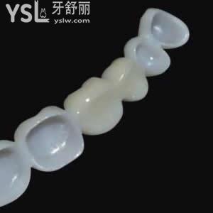 寧波口腔愛爾創(chuàng)全瓷牙收費(fèi)貴不
