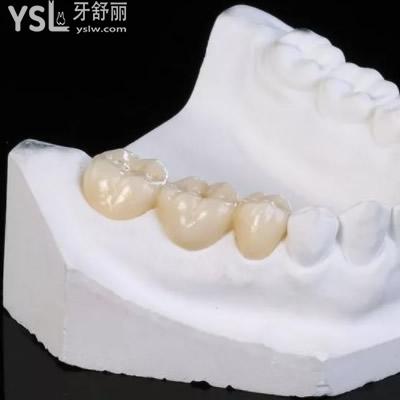 深圳質(zhì)美口腔威蘭德全鋯冠收費(fèi)標(biāo)準(zhǔn)