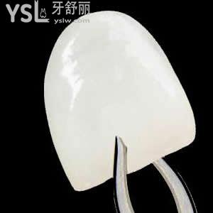 深圳質(zhì)美口腔美國美加超薄貼面價(jià)格表