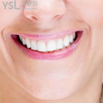 重慶維樂口腔韓國進(jìn)口種植體+基臺(tái)+烤瓷牙冠+手術(shù)費(fèi)價(jià)格表