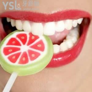 重慶美奧口腔冷光美白收費合理嗎？
