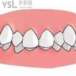 天津中諾口腔牙齒矯正價格一般是多少錢？