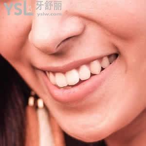 四川成都圣貝牙科金屬自鎖矯正價格超低優(yōu)惠