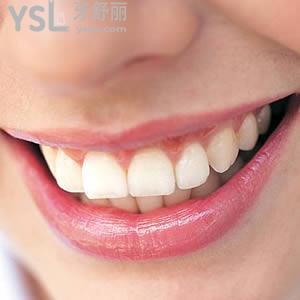 北京圣貝口腔價格表普通金屬托槽矯正活動優(yōu)惠來嘍！