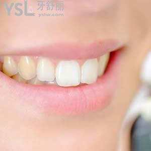 北京圣貝口腔全瓷牙收費(fèi)標(biāo)準(zhǔn)如何。