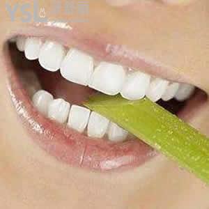 成都極光口腔價(jià)格表MRC咬合誘導(dǎo)暑期超低優(yōu)惠活動(dòng)來襲！