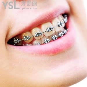北京圣貝口腔價(jià)目表樹(shù)脂補(bǔ)牙超低優(yōu)惠價(jià)格來(lái)襲！