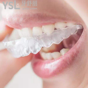 保定合眾口腔收費(fèi)標(biāo)準(zhǔn)之隱形矯正多少錢(qián)？?jī)r(jià)格貴嗎？