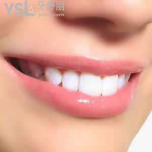 沈陽歡樂仁愛口腔醫(yī)院收費(fèi)標(biāo)準(zhǔn)之隱形矯正暑期價(jià)格多少錢？