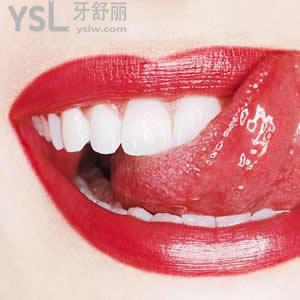 廣州圣貝口腔之超聲波潔牙價(jià)格大概多少錢？