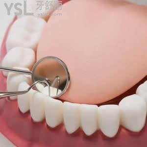 廣州圣貝口腔牙齒美白的收費(fèi)標(biāo)準(zhǔn)是多少？