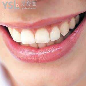 重慶成佳牙博士口腔醫(yī)院瑞典諾貝爾種植牙（基臺(tái)+牙冠）多少錢(qián)？