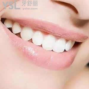 重慶成佳牙博士口腔醫(yī)院隱形矯正（正雅）價(jià)格貴嗎？