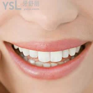 青島牙博士口腔門診部價目表之隱形矯正價格貴嗎？