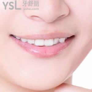 重慶牙博士口腔醫(yī)院收費(fèi)標(biāo)準(zhǔn)之時(shí)代天使隱形矯正（冠軍版）多少錢？