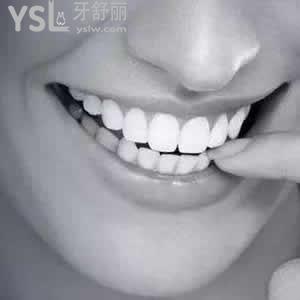 南通牙博士口腔門診部?jī)r(jià)格表之鑄瓷嵌體貴嗎？