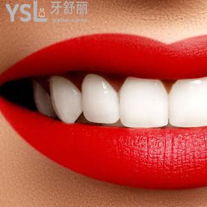 好消息：昆明美奧口腔醫(yī)院正雅全隱形矯正（兩人拼團(tuán)）驚爆價(jià)！