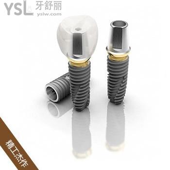 公布?天津中諾口腔價格表，看半口種植牙價格劃算還靠譜