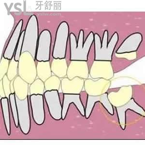 牙科醫(yī)院和醫(yī)院口腔科區(qū)別？
