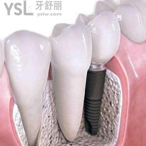 廣東金屬托槽矯正價格多少？珠海九龍口腔價格優(yōu)惠大揭秘