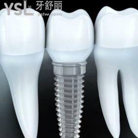 鄭州拜博口腔醫(yī)院價(jià)格表，韓國(guó)dentis種植牙驚爆價(jià)！