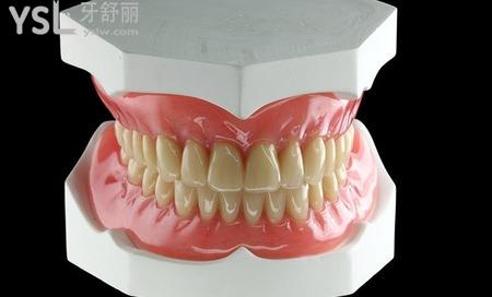 活動義齒修復(fù)過程是什么樣子的？