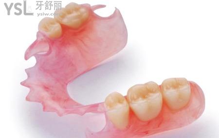 什么是半固定義齒？