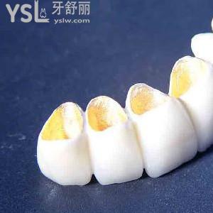 北京做了牙冠多少錢？