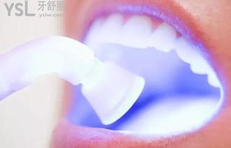 牙齒美白要多少錢？