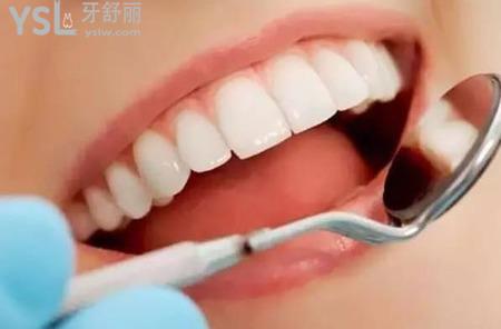 冷光美白牙齒需要注意什么？