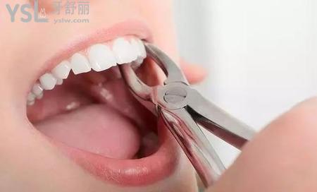 拔完智齒臉會不會??？