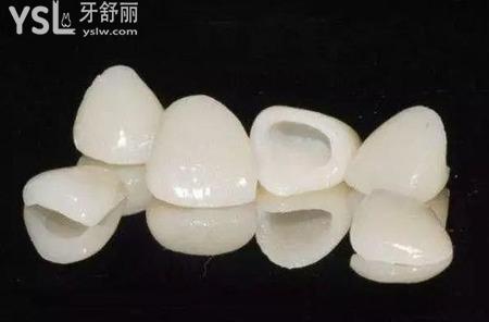 全瓷牙的種類有哪些？