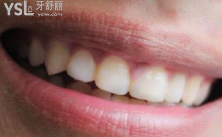 牙發(fā)軟是什么原因？