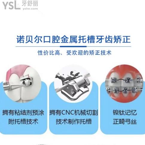 來銀川諾貝爾口腔2周年正畸活動(dòng)!兩人同行做金屬托槽矯正價(jià)格4999元起