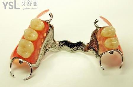 活動(dòng)假牙和固定假牙哪個(gè)比較好？