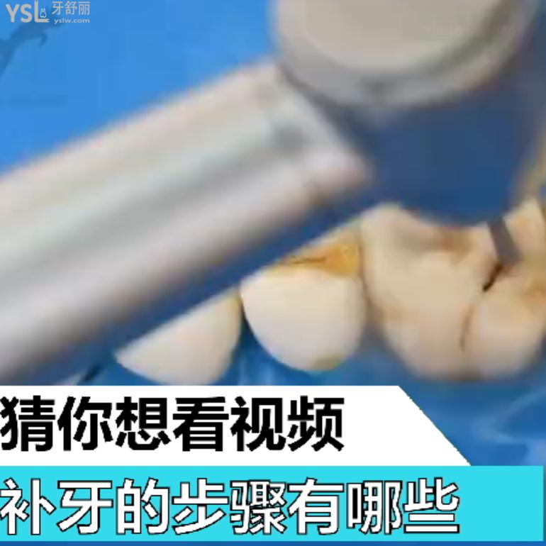 補(bǔ)牙的步驟有哪些？