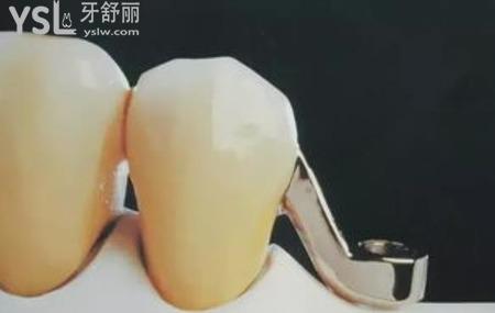 夜晚睡覺磨牙怎么回事？