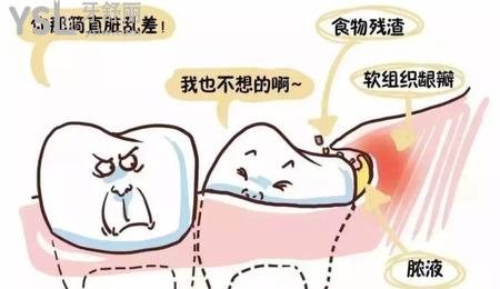 拔智齒后冷敷多長(zhǎng)時(shí)間？