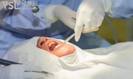 拔智齒后如何防止干槽癥？