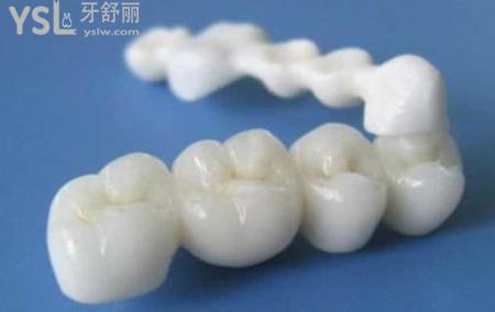 下牙齒掉了一顆,需要補一顆嗎？